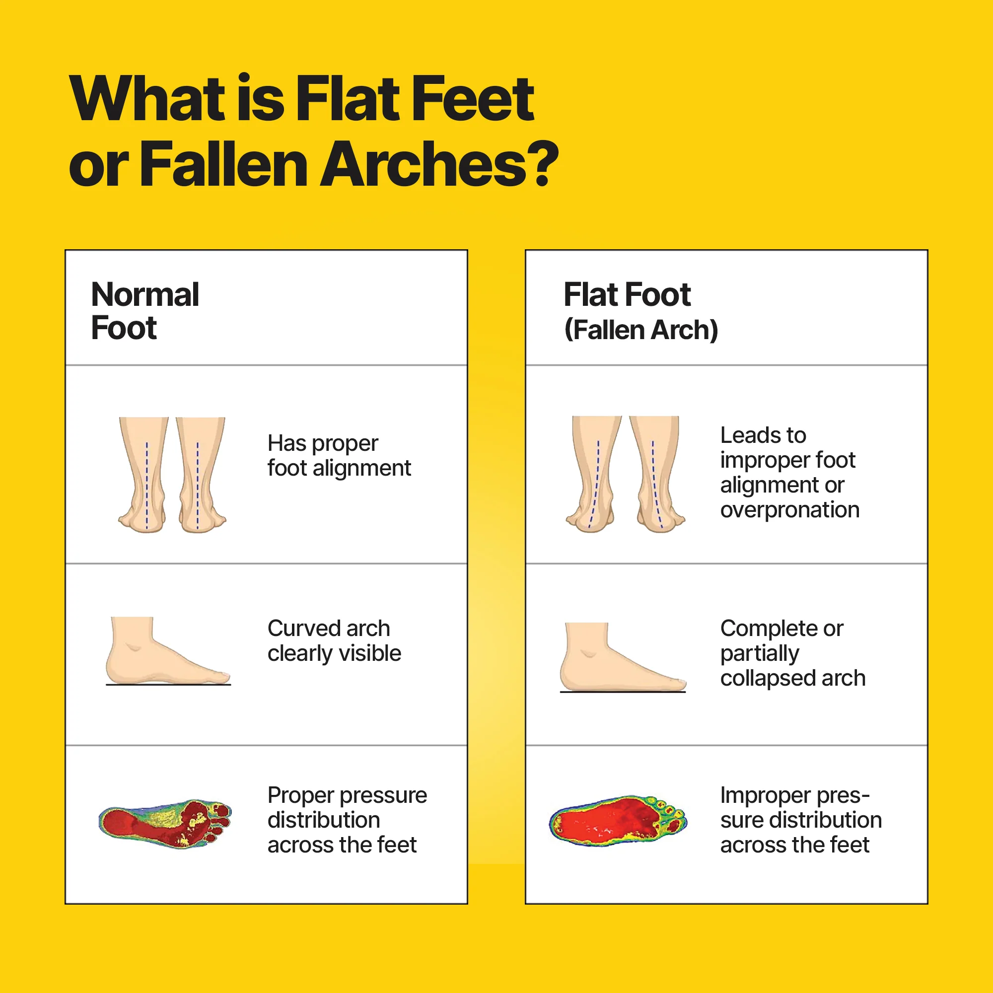 Frido Arch Support Insoles - Image 6