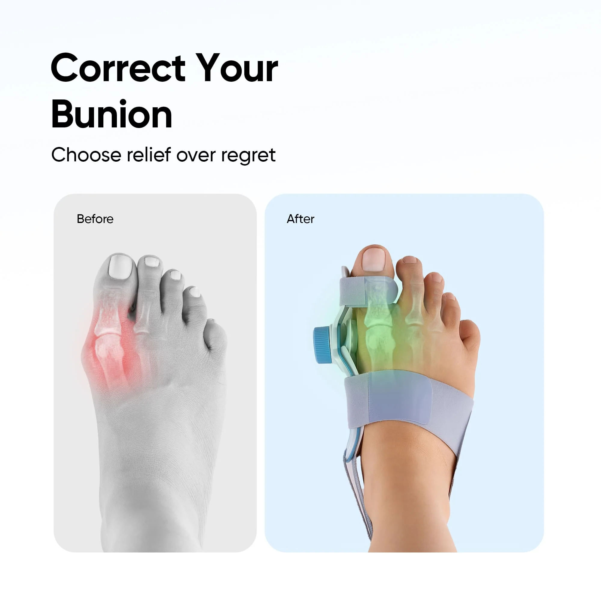 Frido Orthotics Bunion Corrector - Image 10